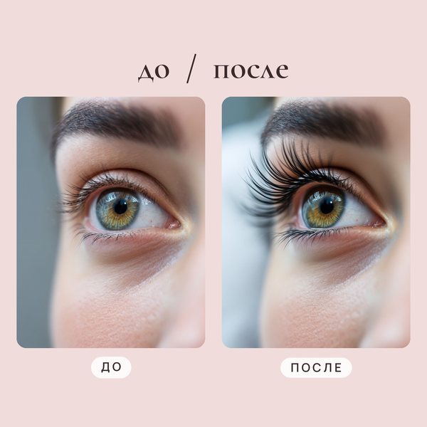 Фото до и после «До и после» — пример